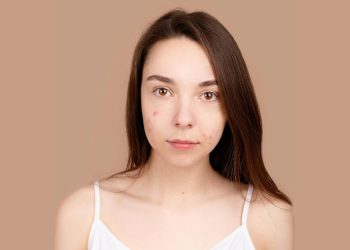 Endometrioza bljeskova? Ove namirnice bi mogle pogoršati stanje